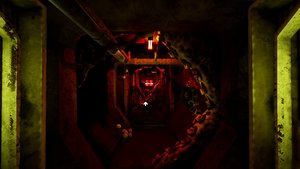 Ultrasound screenshot