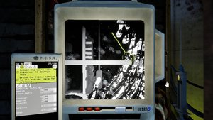 Ultrasound screenshot